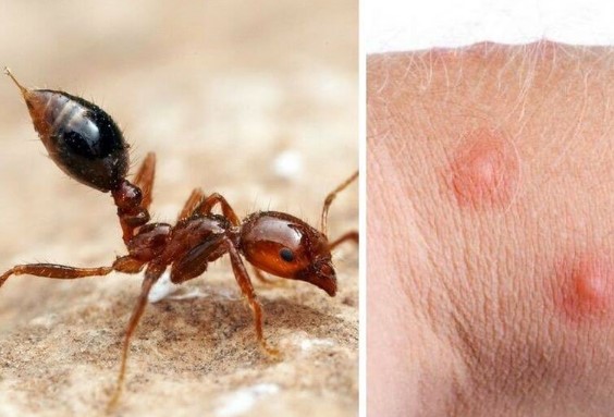  طرق مكافحة النمل الأحمر